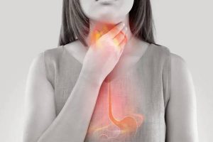 Achalasia-Cardia-Treatment