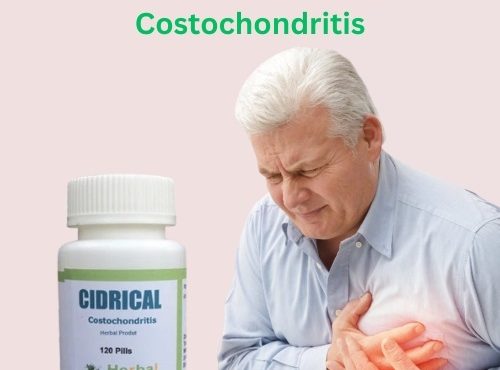 Cidrical Herbal Treatment For Costochondritis
