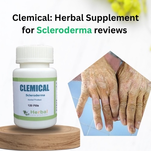 Clemical: Best Herbal Supplement for Scleroderma reviews