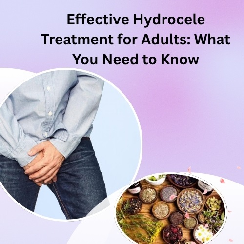 Effective Hydrocele Treatment for Adults: What You Need to Know