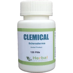 Herbal Treatment for Scleroderma