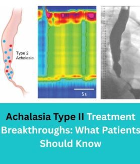 Achalasia Type II Treatment Breakthroughs