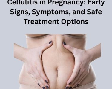Cellulitis in Pregnancy