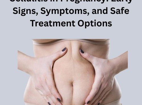 Cellulitis in Pregnancy