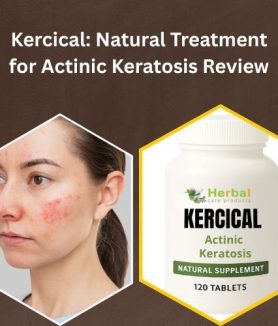 Natural Treatment for Actinic Keratosis Review