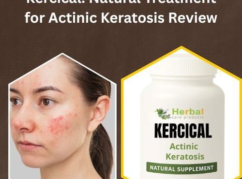 Natural Treatment for Actinic Keratosis Review