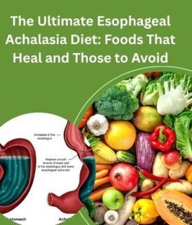 Esophageal Achalasia Diet