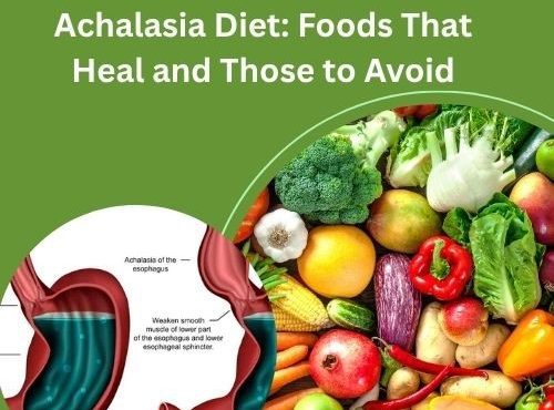 Esophageal Achalasia Diet