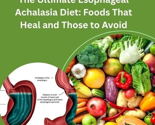 Esophageal Achalasia Diet