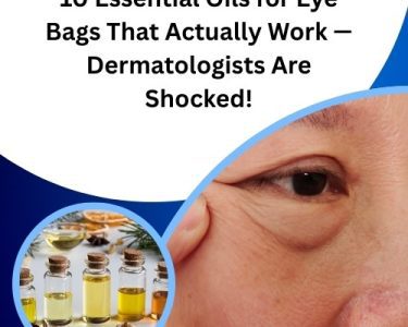 Essential Oils for Eye Bags