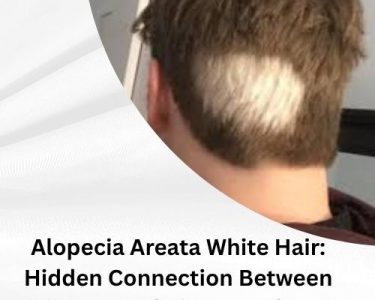 Alopecia Areata White Hair