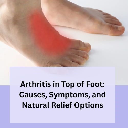 Arthritis in Top of Foot: Causes, Symptoms, and Natural Relief Options