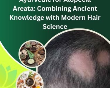 Ayurvedic for Alopecia Areata