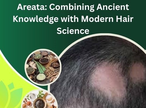 Ayurvedic for Alopecia Areata