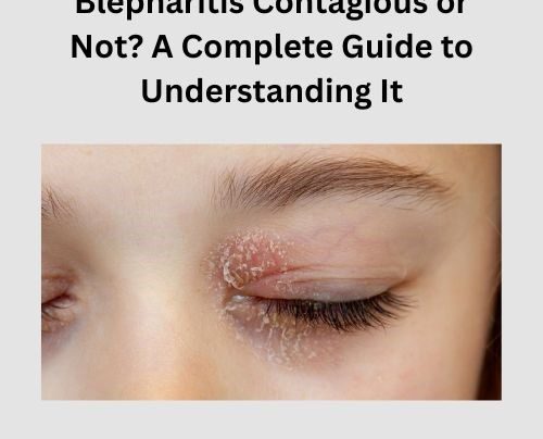 Blepharitis Contagious