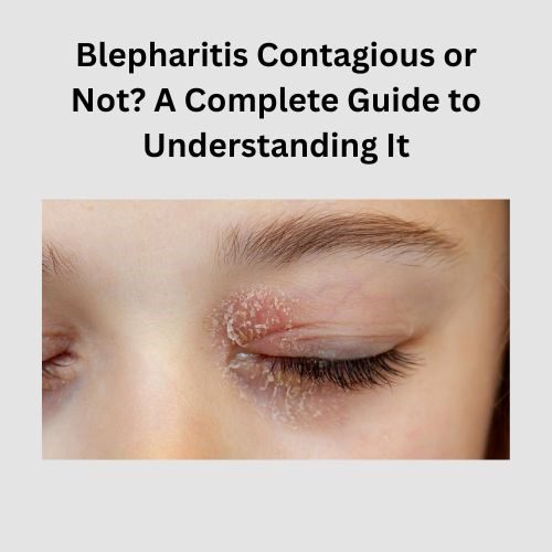 Blepharitis Contagious or Not? A Complete Guide to Understanding It