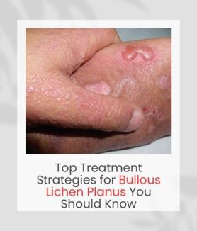 Bullous Lichen Planus