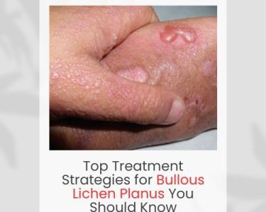 Bullous Lichen Planus