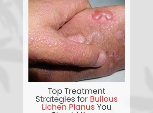 Bullous Lichen Planus