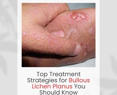 Bullous Lichen Planus
