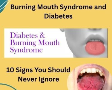 Burning Mouth Syndrome and Diabetes