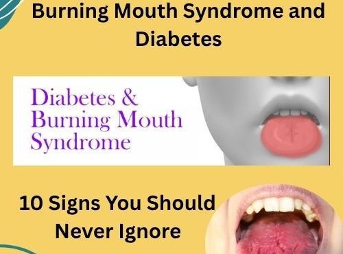 Burning Mouth Syndrome and Diabetes
