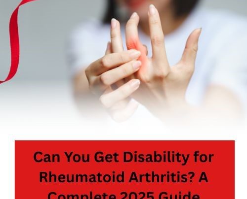Can You Get Disability for Rheumatoid Arthritis