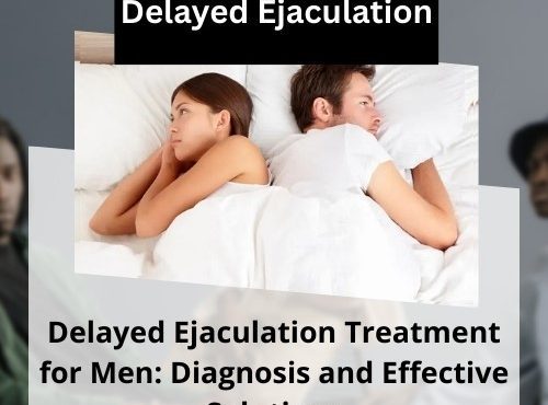 Delayed Ejaculation Treatment for Men