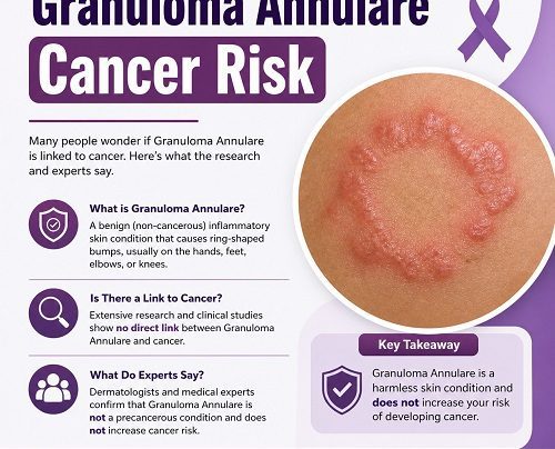 Granuloma Annulare Cancer Risk