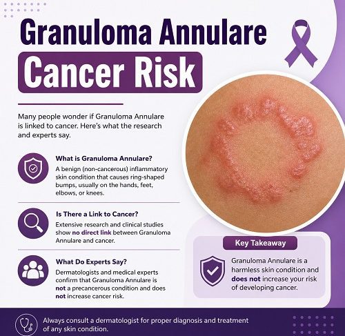 Granuloma Annulare Cancer Risk