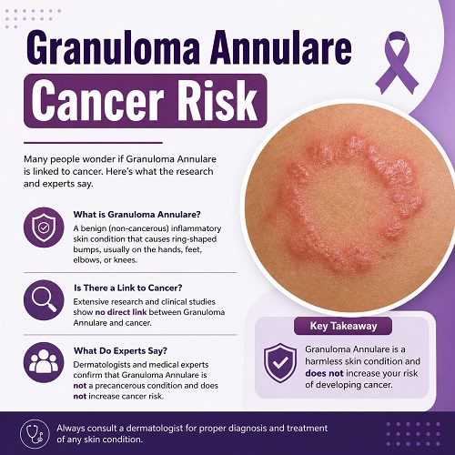 Granuloma Annulare Cancer Risk: The Hidden Link You Must Not Ignore