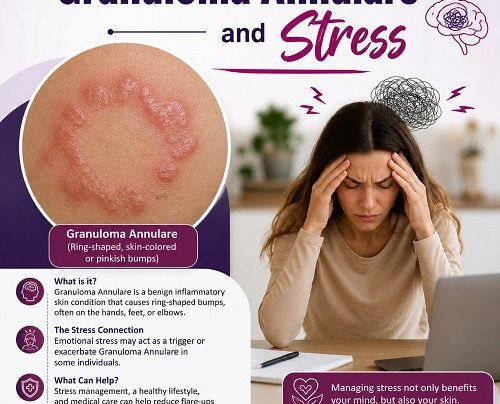 Granuloma Annulare and Stress