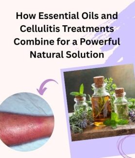 How Essential Oils and Cellulitis Treatments