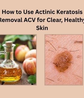 actinic keratosis removal acv​
