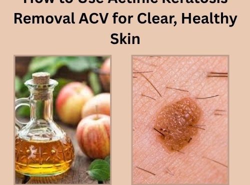 actinic keratosis removal acv​