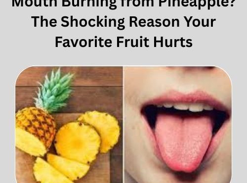 Mouth Burning from Pineapple