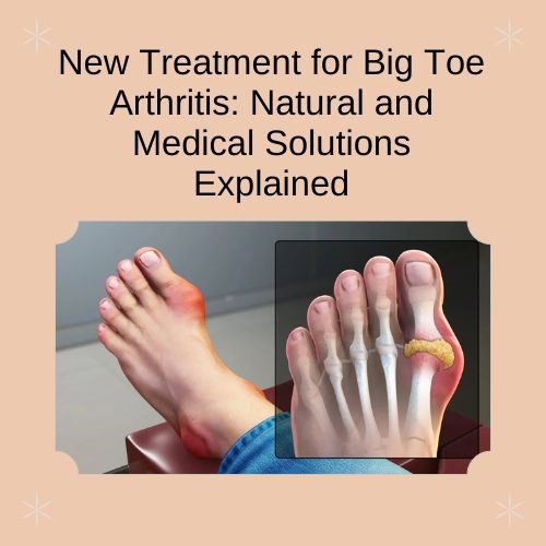 New Treatment for Big Toe Arthritis: Natural and Medical Solutions Explained