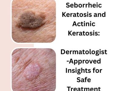 Seborrheic Keratosis and Actinic Keratosis