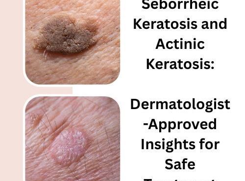 Seborrheic Keratosis and Actinic Keratosis