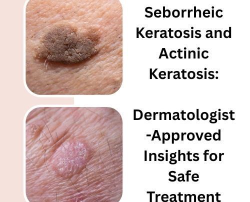 Seborrheic Keratosis and Actinic Keratosis