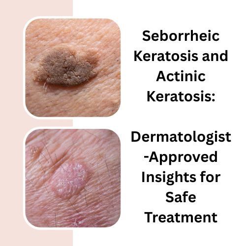 Seborrheic Keratosis and Actinic Keratosis: Dermatologist-Approved Insights for Safe Treatment