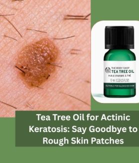 Tea Tree Oil for Actinic Keratosis