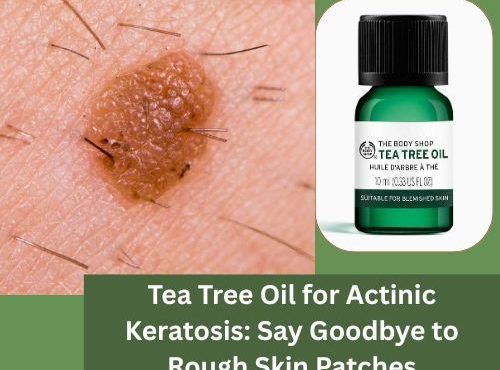 Tea Tree Oil for Actinic Keratosis