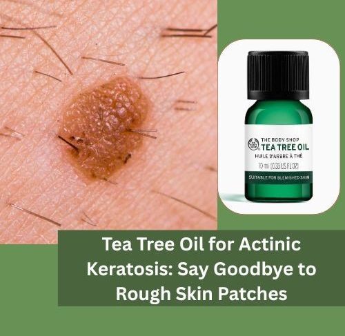 Tea Tree Oil for Actinic Keratosis