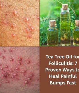 Tea Tree Oil for Folliculitis