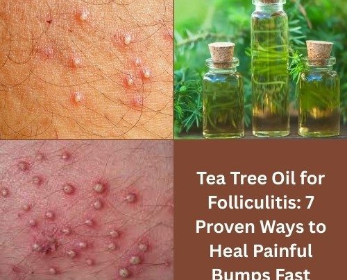 Tea Tree Oil for Folliculitis