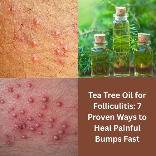 Tea Tree Oil for Folliculitis: 7 Proven Ways to Heal Painful Bumps Fast