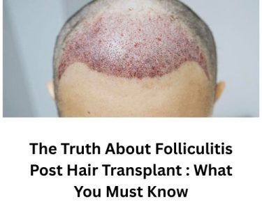 Folliculitis Post Hair Transplant
