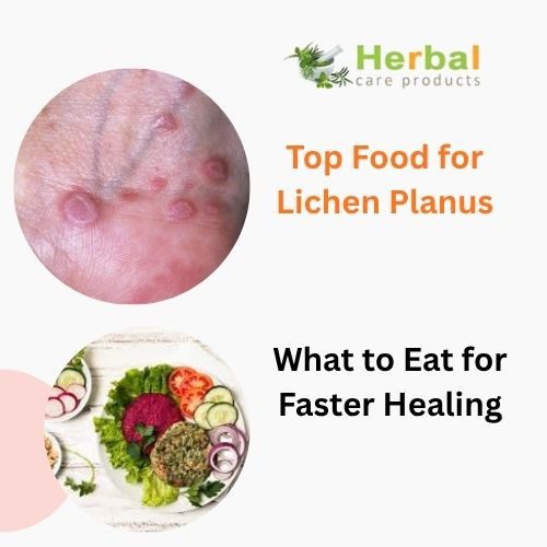 Top Food for Lichen Planus: What to Eat for Faster Healing