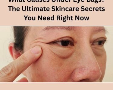 What Causes Under Eye Bags